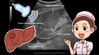 Ecografía de Hígado y vías biliares [upl. by Higley]