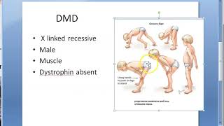 Medicine 070 Duchenne Muscular Dystrophy Dystrophin absent Treatment [upl. by Aleekat]