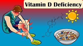 Vitamin D Deficiency  Causes Signs And Symptoms  Everything You Need To Know [upl. by Romelle]