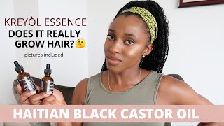 DOES IT GROW HAIR  Kreyol Essence Haitian Black Castor [upl. by Cogn404]