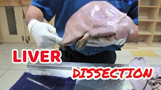 Anatomy Dissection of Liver [upl. by Siroval]