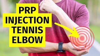 PRP Injection for Elbow Pain  Tennis and Golfers Elbow Treatment [upl. by Pollock]