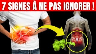 7 Signes Précoces de Lésions Hépatiques À Ne Pas Ignorer [upl. by Lezned]