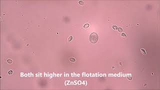 Giardia cysts and Isospora oocyst canine [upl. by Charlet]