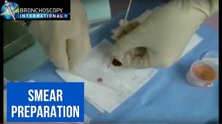 BronchAtlas Smear Preparation [upl. by Trudie882]