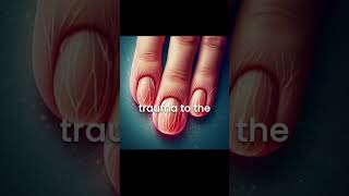 Fingernail Growth Faster Than Toenails Science Explained [upl. by Ijar14]