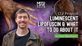 CLF Protocol Luminescent Lipofuscin and What to Do About It [upl. by Scrivenor]