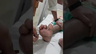 Upgoing plantar reflex positive Babinskis test [upl. by Leinadnhoj144]