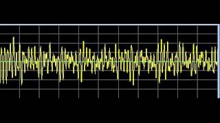 Infections  Rife Frequencies [upl. by Airdna48]