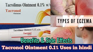 Tacrolimus Ointment 01 Uses and Side effects In hindi  Atopic Dermatitis Eczema How to use [upl. by Leroj227]