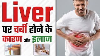 Fatty liverliver me sujanliver me charbi ki Homoeopathic medicine  liver fattyliver fatloss [upl. by Nillek]