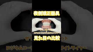 歯列矯正の表側器具の比較 矯正歯科 歯列矯正 orthodontics [upl. by Katzman940]