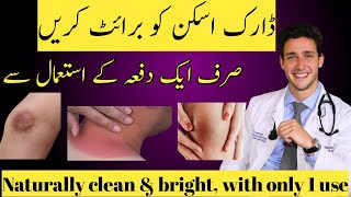 Dark skin removal home remedies  skin brightening  skincare  dark spots [upl. by Iz906]