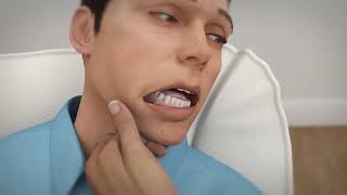 Buccal Midazolam Training Video [upl. by Winifred]