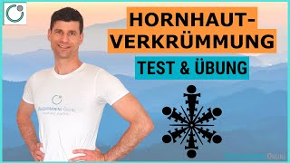 HORNHAUTVERKRÜMMUNG Wegtrainieren  Test Übung amp Training [upl. by Dloreg]