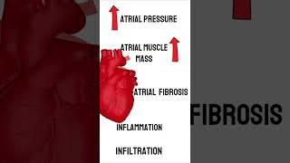 What causes Atrial Fibrillation medicine cardiology medical [upl. by Neelrahs595]