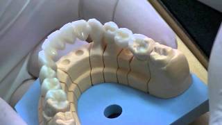 NexxZr Full Contour  Colorazione Zirconia Integrale [upl. by Ardnuasac]