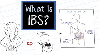 What is IBS Irritable Bowel Syndrome [upl. by Furgeson]