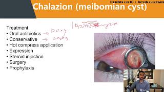 Eyelid Inflammatory Disorders Hindi NEET PG FMGE [upl. by Sand28]