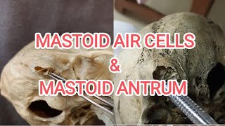 Mastoid air cells and mastoid antrum [upl. by Tews]