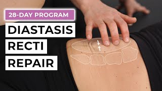 28Day Diastasis Recti Repair Program FREE Challenge [upl. by Suhcnip]