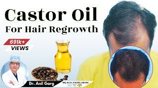 Is Castor Oil Good For Hair Growth  बाल Regrowth के लिए Castor Oil का उपयोग करे  Dr Anil Garg [upl. by Spaulding186]