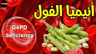 G6PD deficiency انيميا الفول favism 🫛🫘 [upl. by Kono]