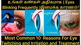 Why Eyes is Blinking Continuously or Frequently 10 Reasons in Tamil கண்கள் அதிகமாக இமைக்க காரணம் [upl. by Aluor]