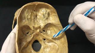 Skull Osteology  Cranial Cavity Anatomy [upl. by Pytlik511]