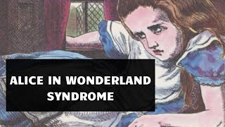 Alice in Wonderland Syndrome [upl. by Chad365]