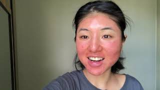 My first chemical peel experience  COSMELAN TREATMENT BY MESOESTETIC [upl. by Slocum]