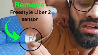 Remove Freestyle Liber 2 Sensor Steps to Remove Freestyle Libre Sensor [upl. by Patsis]