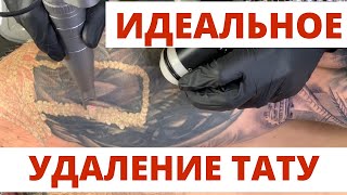 ИДЕАЛЬНОЕ УДАЛЕНИЕ ТАТУ лазером за 5 МЛН РУБЛЕЙ ПРАВИЛЬНОЕ лазерное удаление [upl. by Lacram]