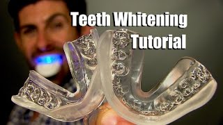 Home Teeth Whitening Tutorial  How To Whiten Your Teeth At Home For Best Results [upl. by Eicarg659]