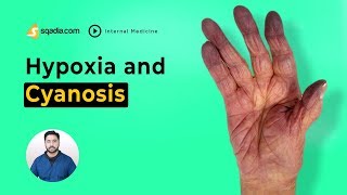 Hypoxia and Cyanosis  Medicine Video Lectures  Student Online  VLearning  sqadiacom [upl. by Aehtrod]