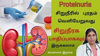 சிறுநீரில் புரதம் போவதால் காணப்படும் அறிகுறிகள் Proteinuria causes and symptoms [upl. by Leotie894]