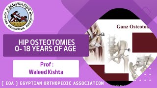 Hip Osteotomies 0 18 Years of Age  Prof Waleed Kishta [upl. by Eixirt]