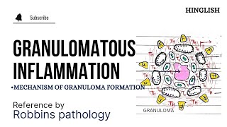 Granulomatous Inflammation  Granuloma formation  Mechanism of Granuloma formation  KTC MBBS [upl. by Wardieu]