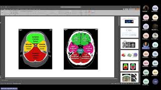 Radiological Anatomy of the CNS by Dr Moustafa Alhassan [upl. by Severson]