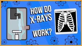 How do XRays Work [upl. by Lyckman769]