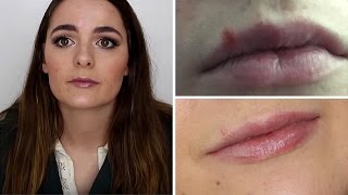 How to Keep COLD SORES Away Get Rid of them FAST and Cover them UP  Brittany OBarr [upl. by Maxey806]