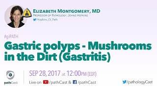 Gastric polyps  Mushrooms in the dirt GASTRITIS [upl. by Ashlen52]