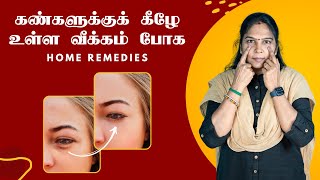 Get Rid of Under Eye Bags Naturally  Tamil Tips  கண்களுக்குக் கீழே உள்ள வீக்கம் போக beautytips [upl. by Katleen878]