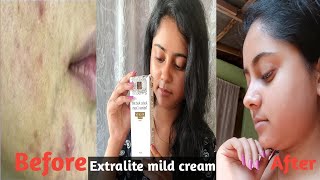 xtralite mild cream Dark spot remover cream  Dailyvlogerpriyanka [upl. by Lotsyrc]