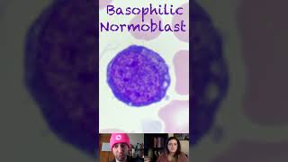 Basophilic Normoblast Morphological Characteristics [upl. by Neiman]