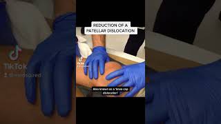 Reduction of a Patellar Dislocation [upl. by Priscella370]