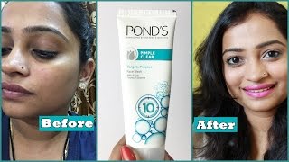 Ponds Pimple Clear Face Wash Review  How to remove Pimple using Face wash  Effective Face Wash [upl. by Pasahow]