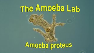 Amoeba Proteus – Time Lapse amp Real time by the Amoeba Lab [upl. by Babb]