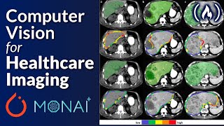 PyTorch and Monai for AI Healthcare Imaging  Python Machine Learning Course [upl. by Panta]