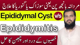 Epididymitis treatment in hindi  Epididymal cyst treatment  sozak Ka ilaj  Epididymitis [upl. by Eemla840]